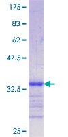 12.5% SDS-PAGE Stained with Coomassie Blue